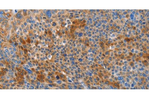 HTRA3 antibody