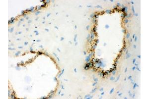 IHC analysis of VWF using anti-VWF antibody . (VWF antibody  (AA 2535-2813))