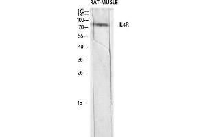 Western Blot (WB) analysis of Rat Muscle lysis using IL4R antibody. (IL4 Receptor antibody)