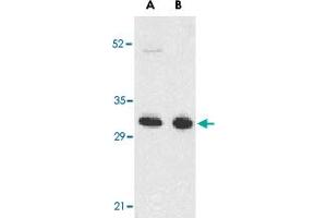 Western blot analysis of TNFRSF13B in K-562 (A) and U-937 (B) cell lysates with TNFRSF13B polyclonal antibody  at 5 ug/mL .