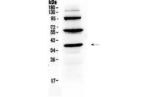 Western blot analysis of Thrombopoietin using anti-Thrombopoietin antibody .