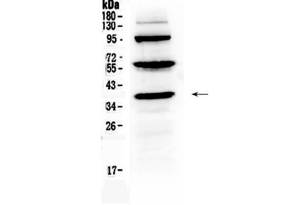 Thrombopoietin anticorps  (AA 22-259)