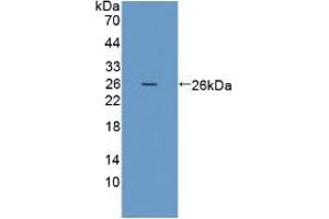 Detection of Recombinant PRSS1, Human using Polyclonal Antibody to Protease, Serine 1 (PRSS1) (PRSS1 antibody  (AA 51-228))