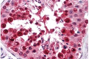 Human Testis: Formalin-Fixed, Paraffin-Embedded (FFPE) (PCBP2 antibody  (AA 1-363))