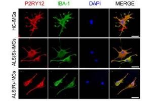 Immunocytochemcial staining of the three groups of iMGs. (P2RY12 antibody  (AA 141-240))