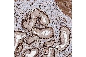 Immunohistochemical staining of human gallbladder with MATR3 polyclonal antibody  shows strong niclear positivity in glandular cells. (MATR3 antibody)