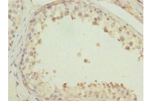 TMEM166 antibody  (AA 58-152)