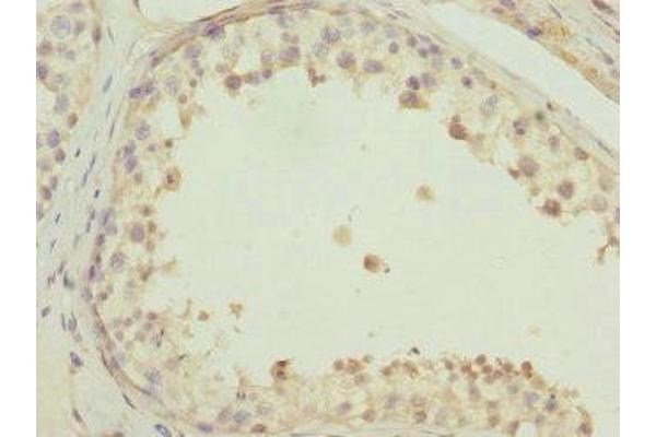 TMEM166 antibody  (AA 58-152)
