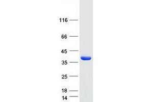 Western Blotting (WB) image for 2-Aminoethanethiol (Cysteamine) Dioxygenase (ADO) protein (Myc-DYKDDDDK Tag) (ABIN2714421)