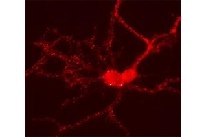 Indirect immunolabeling of PFA fixed cultured rat hippocampus neurons (dilution 1 : 500). (HOMER2 antibody  (AA 1-176))