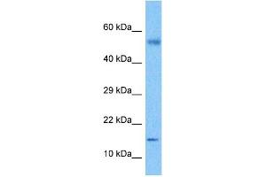 Host:  Rabbit  Target Name:  CSF2  Sample Tissue:  Lymph Node Tumor lysates  Antibody Dilution:  1ug/ml (GM-CSF antibody  (C-Term))