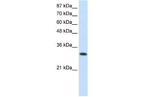 WB Suggested Anti-SCYE1 Antibody Titration:  0. (AIMP1 antibody  (N-Term))