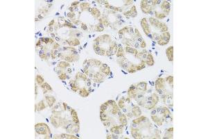 Immunohistochemistry of paraffin-embedded human stomach using PPP1CC antibody. (PPP1CC antibody)