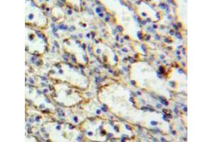 Used in DAB staining on fromalin fixed paraffin-embedded spleen tissue (PAG1 antibody  (AA 160-390))