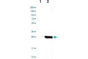 Western blot analysis of Lane 1: Negative control (vector only transfected HEK293T lysate), Lane 2: Over-expression lysate (Co-expressed with a C-terminal myc-DDK tag (~3. (CSDC2 antibody)
