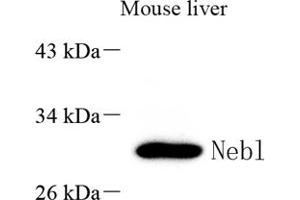 Western blot analysis of Nebulette (ABIN7074788) at dilution of 1: 2000 (Nebulette antibody)