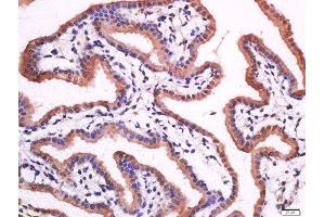 anti-Hydroxyprostaglandin Dehydrogenase 15-(NAD) (HPGD) (AA 55-160) antibody