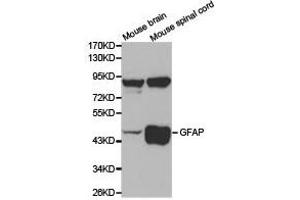 Western Blotting (WB) image for anti-Glial Fibrillary Acidic Protein (GFAP) antibody (ABIN1872799) (GFAP antibody)
