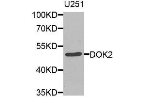 Western blot analysis of extracts of U-251MG cells, using DOK2 antibody (ABIN5974600) at 1/1000 dilution. (DOK2 antibody)