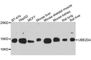 Western blot analysis of extracts of various cell lines, using UBE2D4 antibody. (UBE2D4 antibody  (AA 1-147))