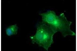 Image no. 4 for anti-Melan A (MLANA) antibody (ABIN1499423) (MLANA antibody)