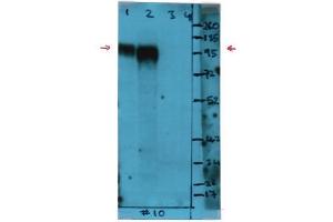 Western Blot analysis using CD107b / LAMP2 Antibody Cat. (LAMP2 antibody)