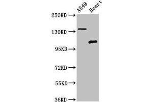 Western Blot Positive WB detected in: A549 whole cell lysate, Rat heart tissue All lanes: ADGRA2 antibody at 3 μg/mL Secondary Goat polyclonal to rabbit IgG at 1/50000 dilution Predicted band size: 143, 120, 20 kDa Observed band size: 143, 120 kDa (GPR124 antibody  (AA 1069-1338))