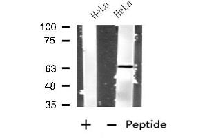 Western blot analysis of extracts from HeLa cells, using IL4I1 antibody. (IL4I1 antibody  (N-Term))