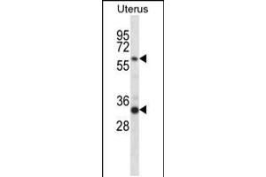 Western blot analysis in human normal Uterus tissue lysates (35ug/lane). (Fam172a antibody  (AA 203-232))