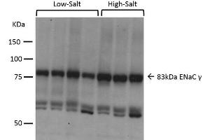 Western blot analysis of Mouse kidney cortex showing detection of ENaC protein using Rabbit Anti-ENaC Polyclonal Antibody . (SCNN1A antibody  (AA 629-650) (PerCP))