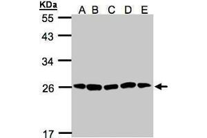 WB Image Sample(30μg of whole cell lysate) A: H1299 B: HeLa S3 , C: Hep G2 , D: MOLT4 , E: Raji , 12% SDS PAGE antibody diluted at 1:1000 (PSMA2 antibody  (Center))