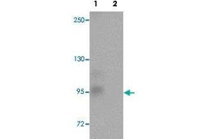 Western blot analysis of rat brain tissue with ZC3H12C polyclonal antibody  at 1 ug/mL in (Lane 1) the absence and (Lane 2) the presence of blocking peptide.