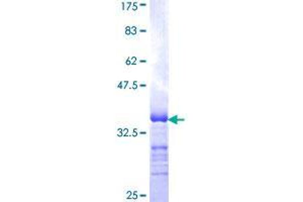 EBF3 Protein (AA 381-480) (GST tag)
