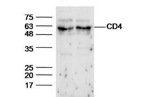 Western Blotting (WB) image for anti-CD4 (CD4) (AA 301-400) antibody (ABIN1385275)