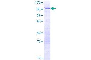 Image no. 1 for Staufen Double-Stranded RNA Binding Protein 1 (STAU1) (AA 1-577) protein (GST tag) (ABIN1321612) (STAU1/Staufen Protein (AA 1-577) (GST tag))