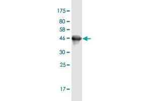 Western Blot detection against Immunogen (45. (UBALD1 antibody  (AA 1-177))