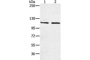 Western Blotting (WB) image for anti-Telomerase Reverse Transcriptase (TERT) antibody (ABIN2426079)
