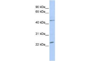WB Suggested Anti-NKX3-1 Antibody Titration:  0. (NKX3-1 antibody  (Middle Region))