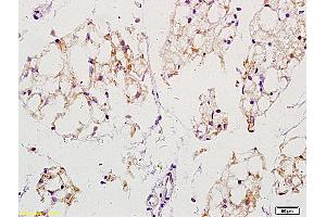 Formalin-fixed and paraffin embedded mouse stomach labeled with Anti-EGFRvIII Polyclonal Antibody, unconjugated  (ABIN742035) at 1: 200 followed by incubation with conjugated secondary antibody and DAB staining (EGFRviii antibody  (AA 1-50))