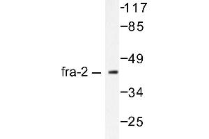 Image no. 1 for anti-FOS-Like Antigen 2 (FOSL2) antibody (ABIN265424) (FOSL2 antibody)