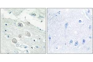 Immunohistochemistry analysis of paraffin-embedded human brain tissue, using JAK1 Antibody.