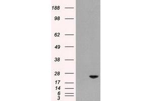 HEK293T cells were transfected with the pCMV6-ENTRY control (Left lane) or pCMV6-ENTRY AK1 (Right lane) cDNA for 48 hrs and lysed. (Adenylate Kinase 1 antibody)