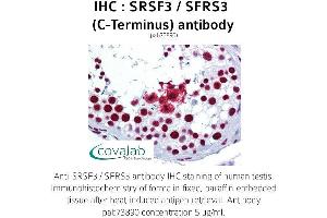 Image no. 1 for anti-serine/arginine-Rich Splicing Factor 3 (SRSF3) antibody (ABIN1739659) (SRSF3 antibody)