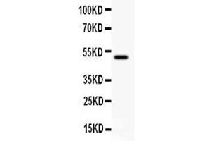 Anti- CD80 antibody, Western blottingAll lanes: Anti CD80  at 0.