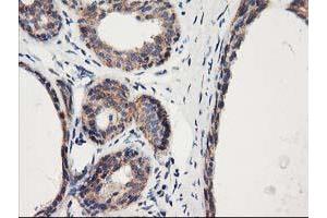 Immunohistochemical staining of paraffin-embedded Human breast tissue using anti-HARS2 mouse monoclonal antibody. (HARS2 antibody)