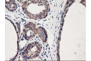 Immunohistochemical staining of paraffin-embedded Human breast tissue using anti-HARS2 mouse monoclonal antibody.