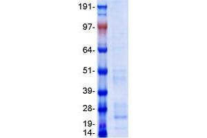Validation with Western Blot (BST2 Protein (Myc-DYKDDDDK Tag))