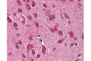 Immunohistochemistry (IHC) image for anti-Autophagy Related 12 (ATG12) (C-Term) antibody (ABIN2774244)