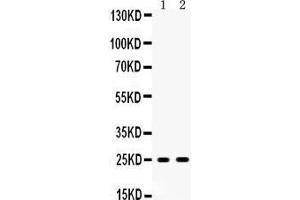 Anti- Peroxiredoxin 6 Picoband antibody, Western blotting All lanes: Anti Peroxiredoxin 6  at 0. (Peroxiredoxin 6 antibody  (AA 15-224))