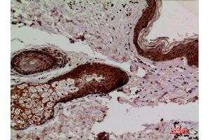 Immunohistochemistry (IHC) analysis of paraffin-embedded Human Skin, antibody was diluted at 1:100. (KEAP1 antibody  (Internal Region))